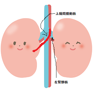 くるみ割り現象 ナッツクラッカー現象 年6月18日 有馬医院